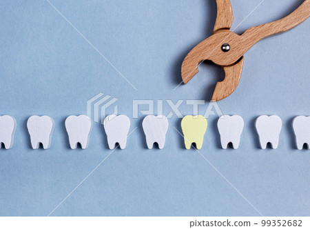 Extracting caries tooth from healthy teeth row 99352682