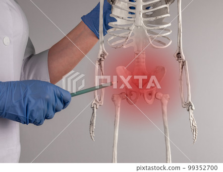 Doctor hand pointing to skeleton pelvis with red spot. Skeletal system anatomy, body structure, medical education concept. Reproductive, urinary or digestive systems. 99352700
