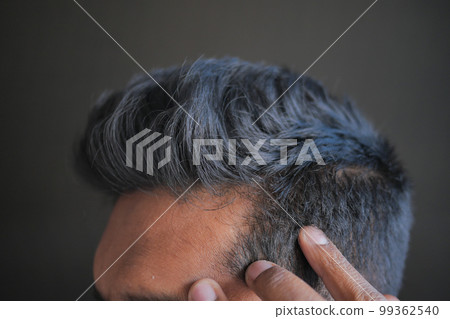 hair loss concept with man checking his hair hair loss concept with man checking his hair 99362540