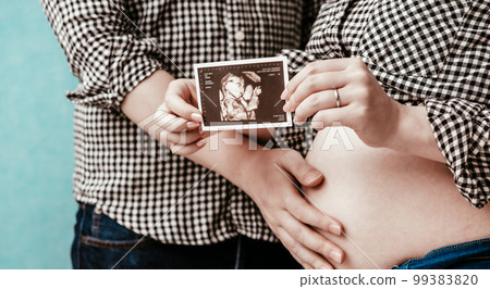 Pregnant woman 99383820