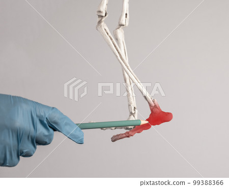 Doctor hand pointing to human skeleton foot with red point. Heel, ankle, forefoot pain. Injury, excessive physical activity, ill-fitting shoes. Skeletal system anatomy, medical education concept. Doctor hand pointing to human skeleton foot with red point. Heel, ankle, forefoot pain. Injury, excessive physical activity, ill-fitting shoes. Skeletal system anatomy, medical education concept. 99388366