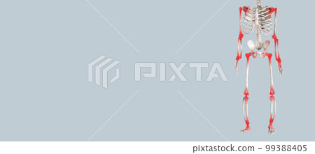 Banner with skeleton with red points at painful joints. Arthritis consequences. Health problems, medical conditions concept. Copy space Banner with skeleton with red points at painful joints. Arthritis consequences. Health problems, medical conditions concept. Copy space 99388405