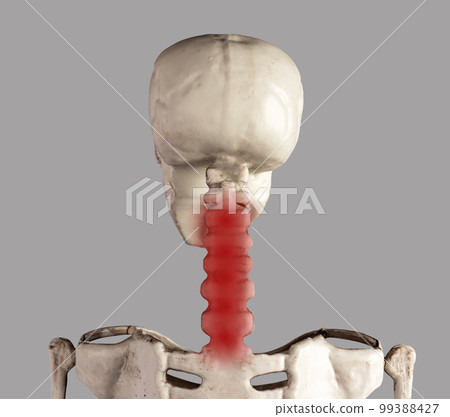 Human skeleton cervical vertebrate with red point. Neck pain, stiffness. Inflammation, injury, poor posture, overuse consequences. Health problems, anatomy concept. Human skeleton cervical vertebrate with red point. Neck pain, stiffness. Inflammation, injury, poor posture, overuse consequences. Health problems, anatomy concept. 99388427