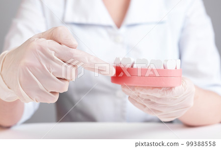 Gingiva inflammation. Dentist forefinger pointing to red point at jaw model with teeth. Swollen, painful gums. Gingivitis, periodontitis, poor oral hygiene, stomatology concept. Gingiva inflammation. Dentist forefinger pointing to red point at jaw model with teeth. Swollen, painful gums. Gingivitis, periodontitis, poor oral hygiene, stomatology concept. 99388558