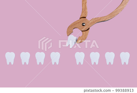 Teeth row and forceps for tooth extraction. Oral health problems and dentist work concept on pastel background. Children game at doctor. Teeth row and forceps for tooth extraction. Oral health problems and dentist work concept on pastel background. Children game at doctor. 99388913