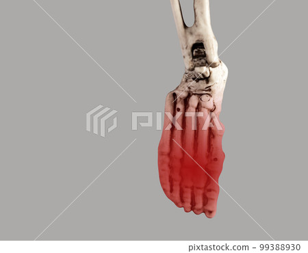 Human skeleton foot with red point at forefoot. Injury, excessive physical activity, ill-fitting shoes consequences. Pain, swelling, redness. Health problems, anatomy concept. 99388930