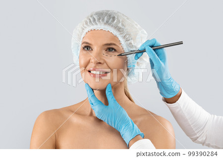 Plastic surgeon drawing contours around female patient eye before surgery Plastic surgeon drawing contours around female patient eye before surgery 99390284