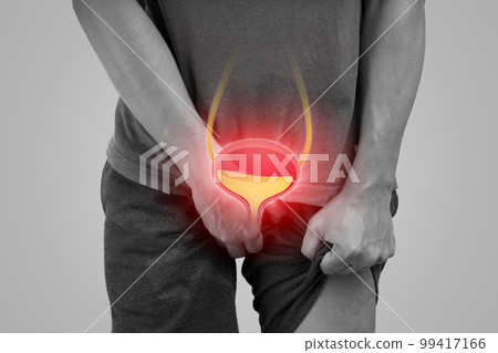 Urinary hesitancy symptoms. 99417166