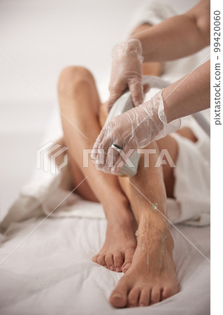 remove hair, Laser epilation, beauty salon. Cosmetology and spa concept, low section of young woman receiving laser treatment on leg at spa for laser epilation remove hair, Laser epilation, beauty salon. Cosmetology and spa concept, low section of young woman receiving laser treatment on leg at spa for laser epilation 99420060