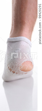 Torn white sock on man leg closeup Torn white sock on man leg closeup 99420291