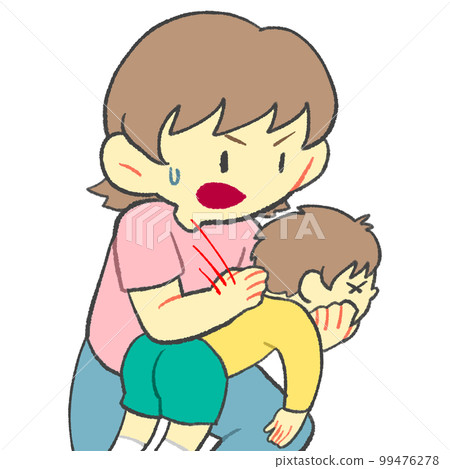 Back blow method infant child 99476278