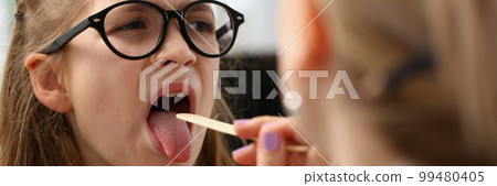 Tonsillitis colds and flu in children with sore throat Tonsillitis colds and flu in children with sore throat 99480405