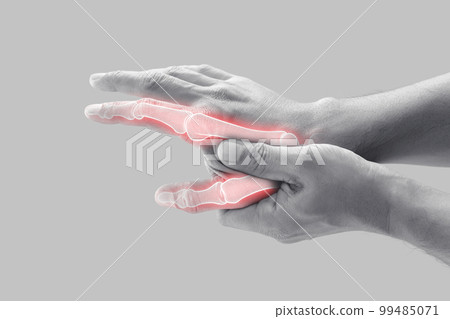Man having bone pain in index finger and thumb. 99485071