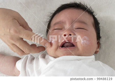 在哭泣的嬰兒臉上塗抹面霜的圖片（0 歲 2 個月，日本，男孩） 99486119