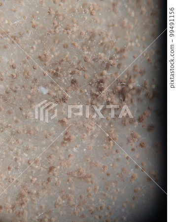 黑曲霉的孢子是如何變色的 黑曲霉的孢子是如何變色的 99491156