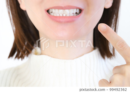 woman showing teeth woman showing teeth 99492362
