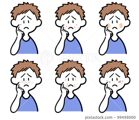 A set of men suffering from skin troubles 99498000