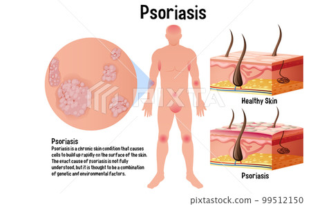 Human skin conditions infographic with explanation 99512150