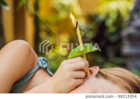 Ear candling being carried out on an attractive caucasian woman in a spa Ear candling being carried out on an attractive caucasian woman in a spa 99513954