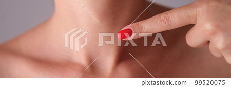 Young woman pointing her finger at neck closeup 99520075