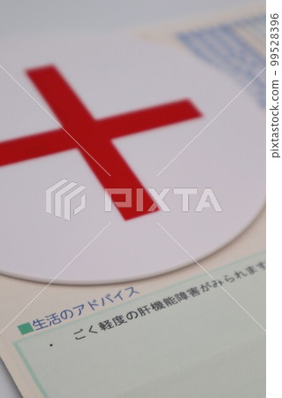 健康檢查時輕度肝功能障礙 99528396