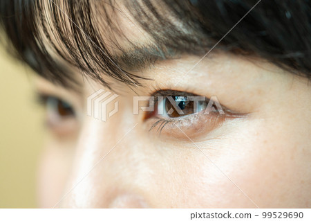 雙眼部位 99529690
