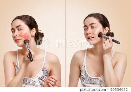A young pretty woman applies makeup with a brush to the reddish area of inflammation. Before and after. Beige background. The concept of corrective makeup and rosacea A young pretty woman applies makeup with a brush to the reddish area of inflammation. Before and after. Beige background. The concept of corrective makeup and rosacea 99534622
