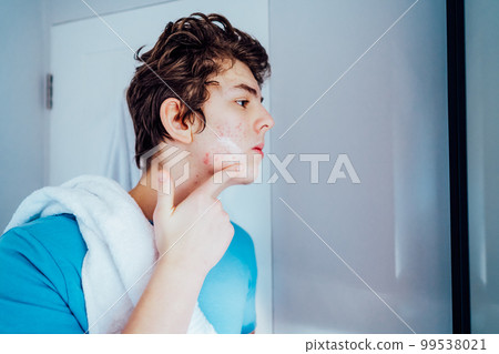 Concentrated caucasian teenage boy with acne problem take care his face skin at home. He looking in mirror and aplying cream on the face in bathroom. Teenager skin care every day treatment process Concentrated caucasian teenage boy with acne problem take care his face skin at home. He looking in mirror and aplying cream on the face in bathroom. Teenager skin care every day treatment process 99538021
