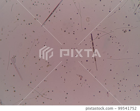 Plankton living in freshwater 99541752