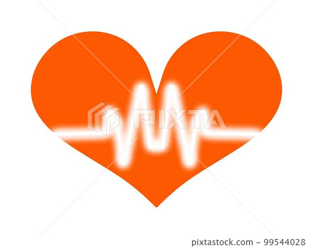 ECG waveform image ECG waveform image 99544028