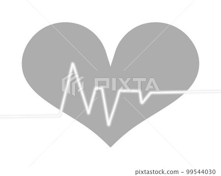 ECG waveform image ECG waveform image 99544030