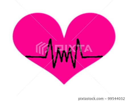 ECG waveform image ECG waveform image 99544032