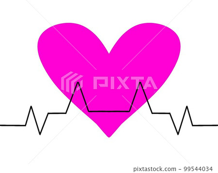ECG waveform image ECG waveform image 99544034