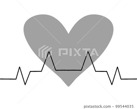 ECG waveform image ECG waveform image 99544035