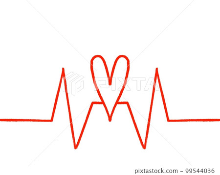 ECG waveform image ECG waveform image 99544036