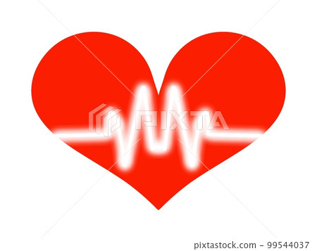 ECG waveform image ECG waveform image 99544037