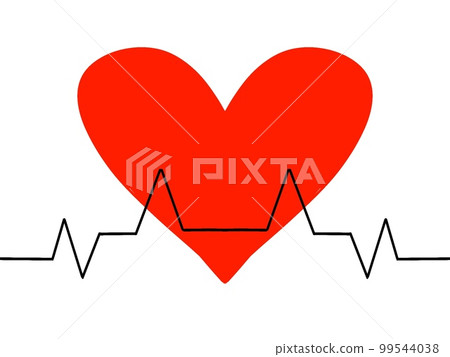 ECG waveform image ECG waveform image 99544038
