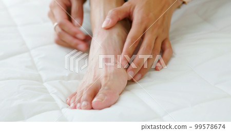 woman has foot eczema 99578674