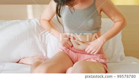 woman pinch excessive fat belly 99578780
