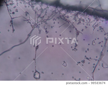 Bacteria collected from the natural world, thought to be actinomycetes Bacteria collected from the natural world, thought to be actinomycetes 99583674