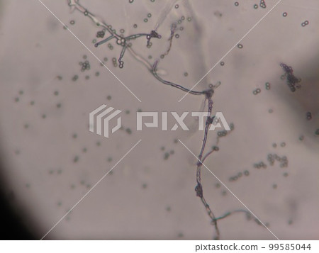 Actinomycete arthrospores collected from nature 99585044