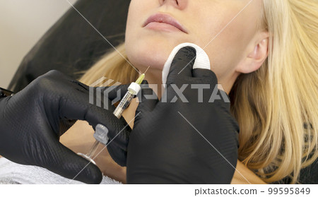Woman gets volume to chin, reshapes with filler, injection. White female lying on couch. Beauty physician holds syringe near girl's face.Chin reshaping, augmentation.Cosmetologist, aesthetic medicine 99595849