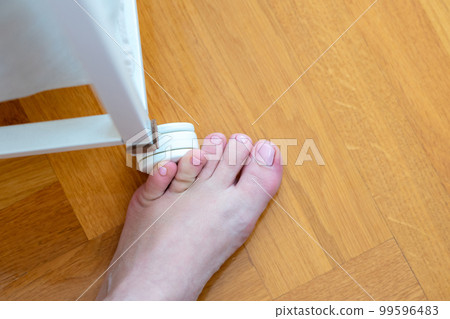 Woman hit furniture with the little toe. Incident at home. Injury of foot little finger 99596483