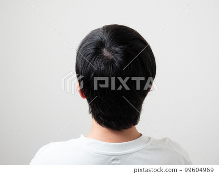 男性枕毛漩渦 99604969