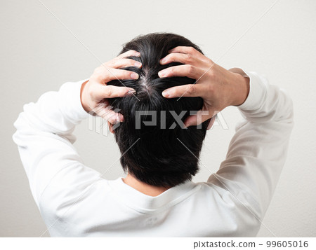 Male occipital hair whirlpool 99605016