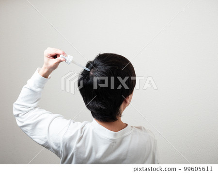 男人在後腦勺上應用生髮劑頭髮 男人在後腦勺上應用生髮劑頭髮 99605611