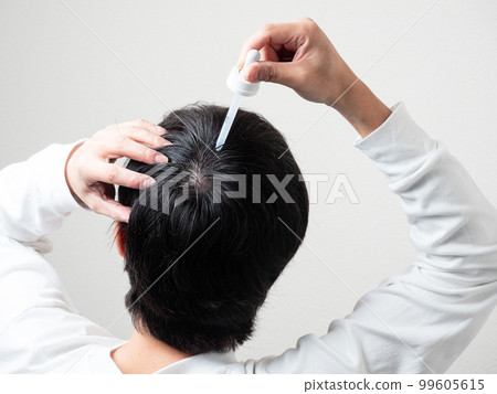 男人在後腦勺上應用生髮劑頭髮 男人在後腦勺上應用生髮劑頭髮 99605615