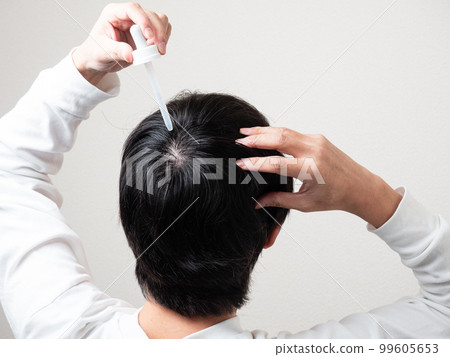 男人在後腦勺上應用生髮劑頭髮 99605653