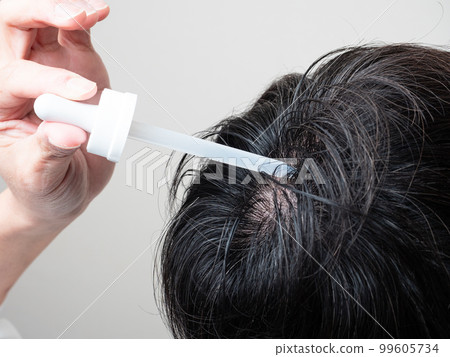 應用生髮劑，螺紋頭髮的人 99605734