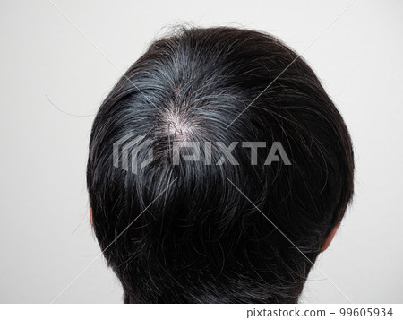 Men's hair, close-up of whorls Men's hair, close-up of whorls 99605934